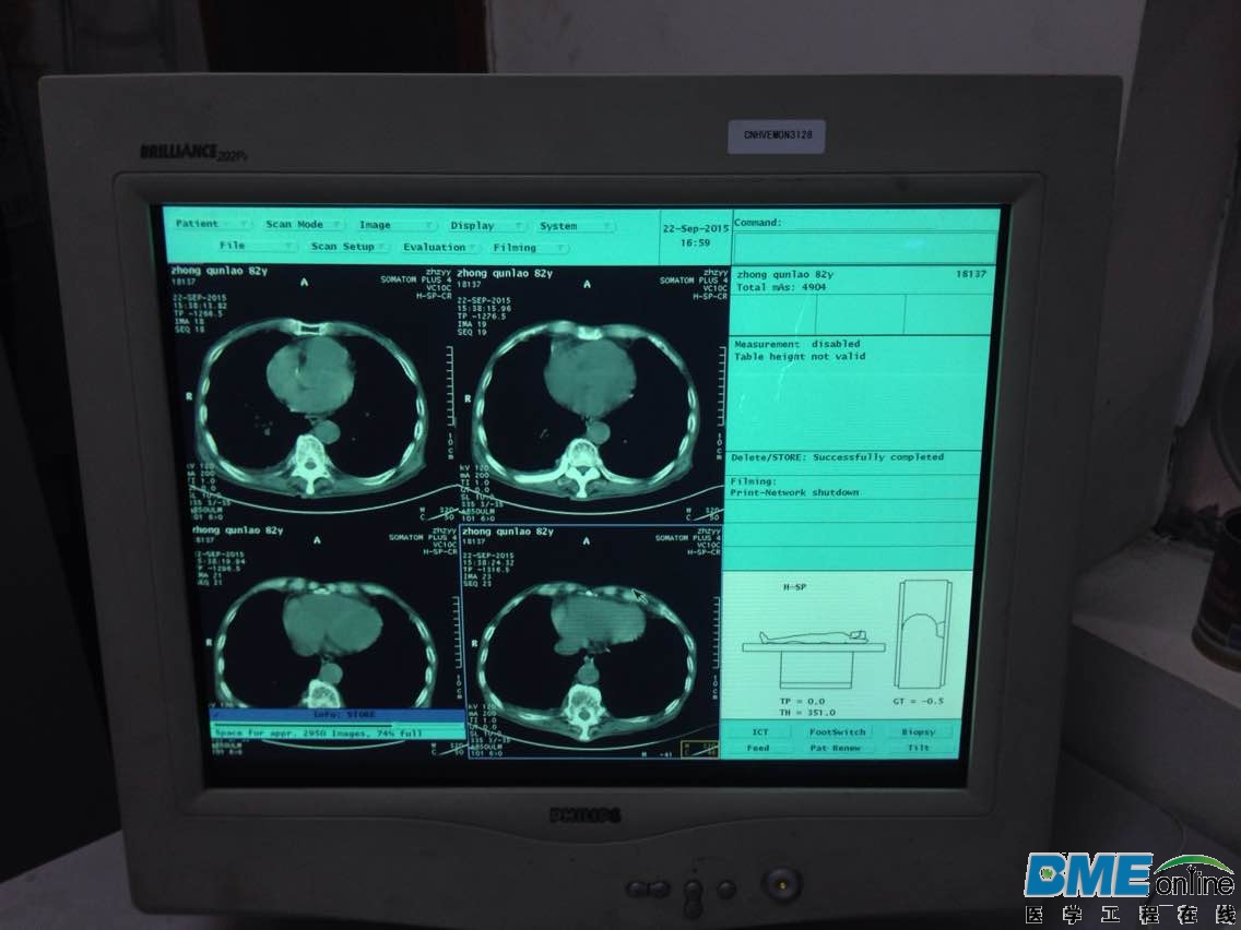西门子的ct，是飞利浦的显示器，应该不是原装的显示器吧