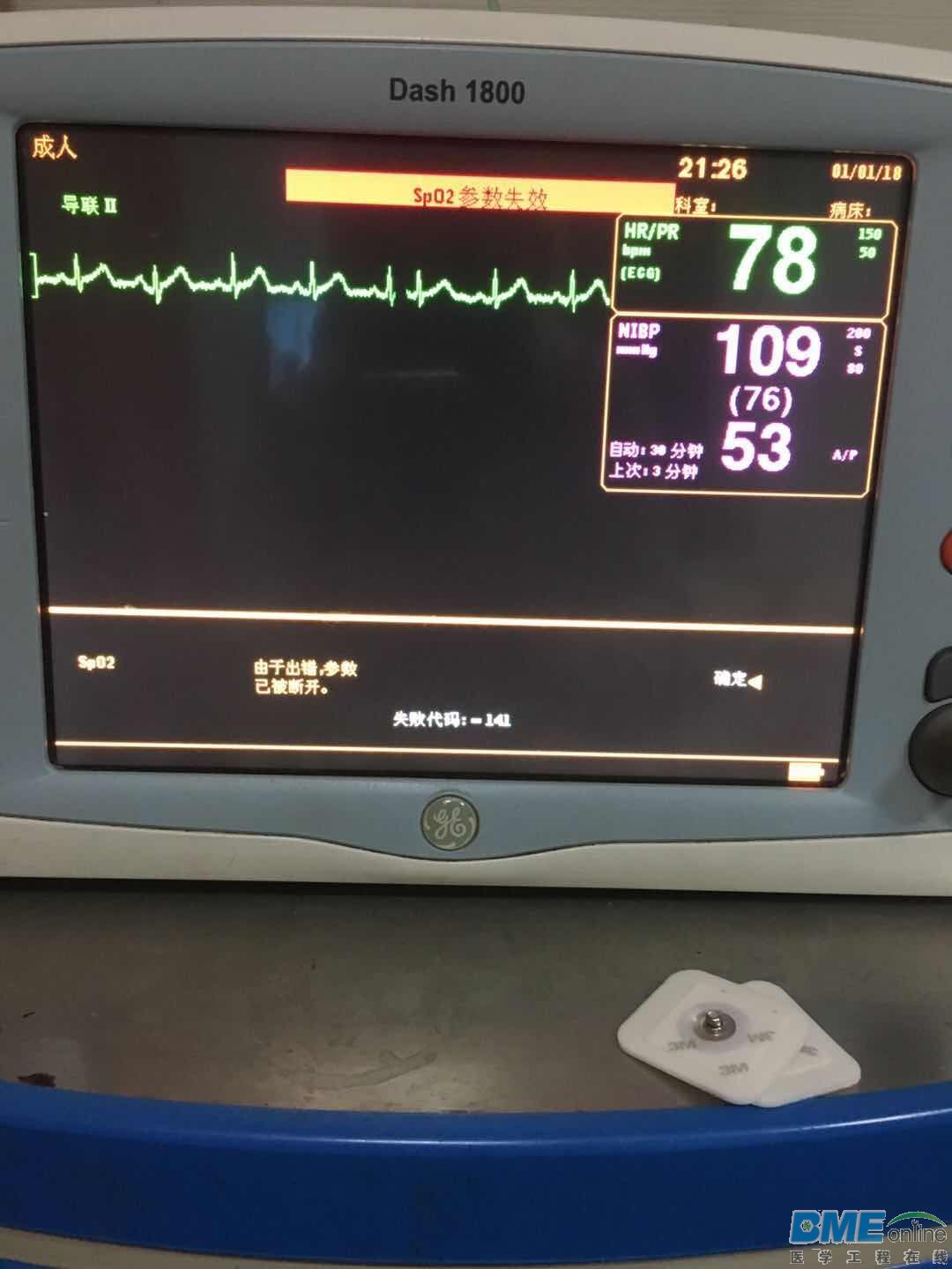 肺一监护仪故障.jpg